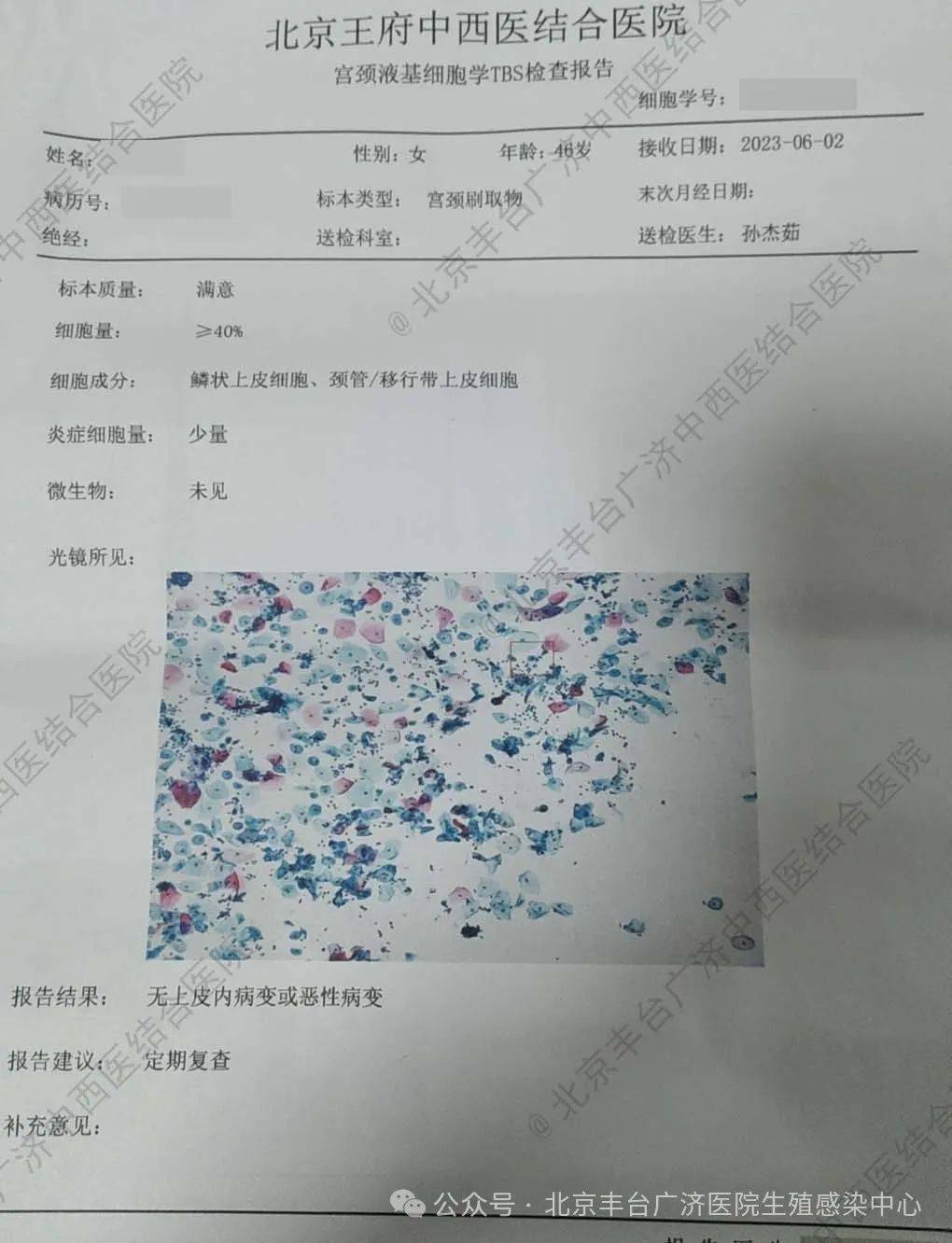 患者2023年复查hpv16阳性,tct检测显示无上皮内病变或恶性病变