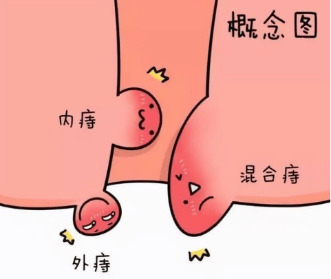 女性肛门旁边长痣图片