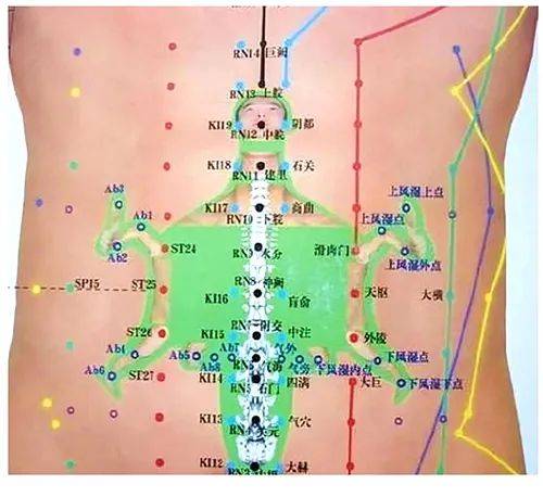 安全无痛腹针疗法是一种独特的全息针灸疗法,其特色在于通过针刺以