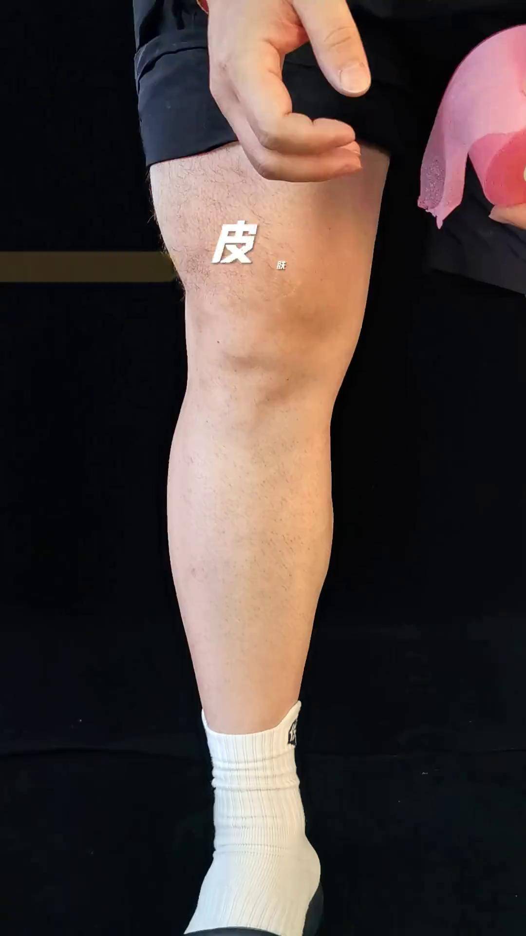 运动防护 皮肤膜 体育生 髌骨带