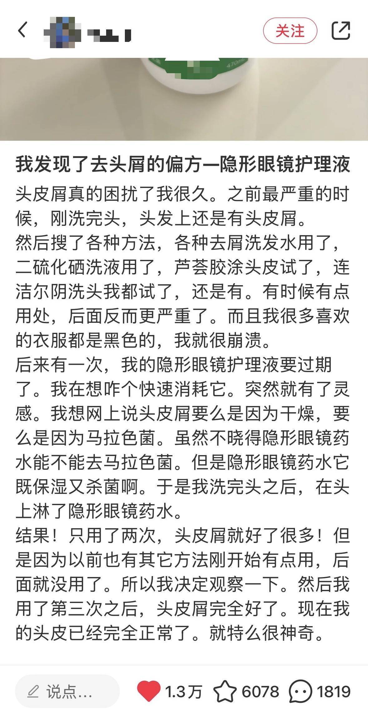 隐形眼镜护理液治头皮屑有奇效？“偏方”可信吗，专家这样说……