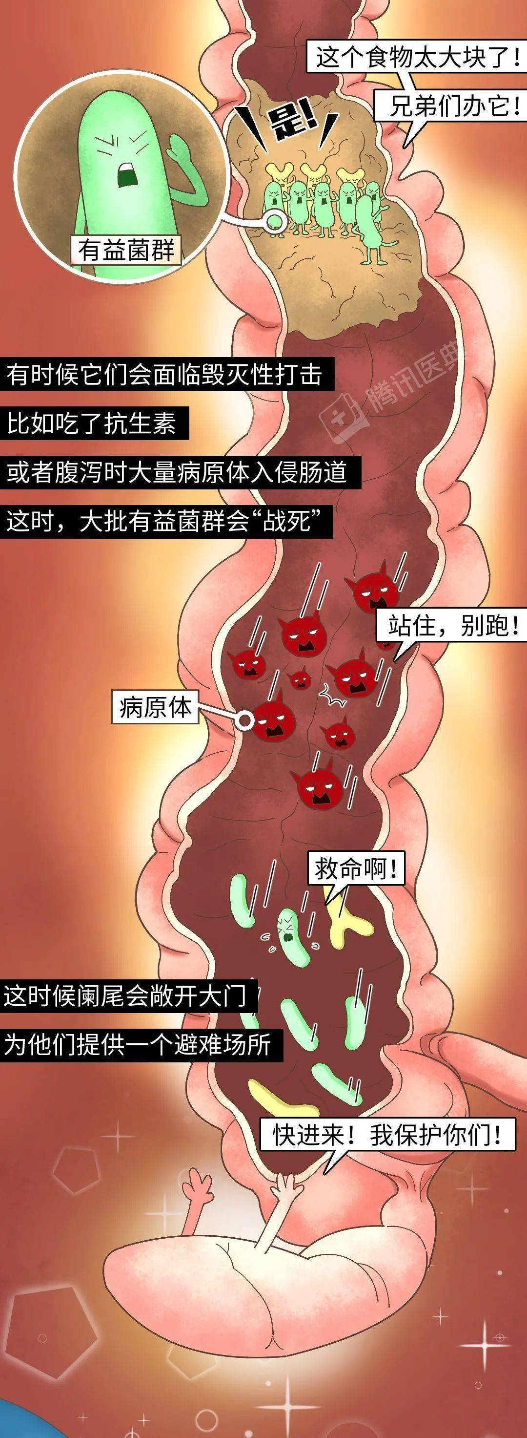 阑尾炎手术后图片真实图片