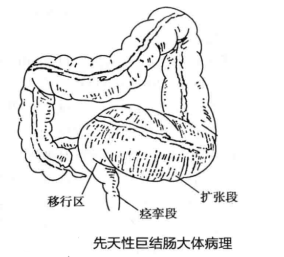 降结肠图片位置示意图图片