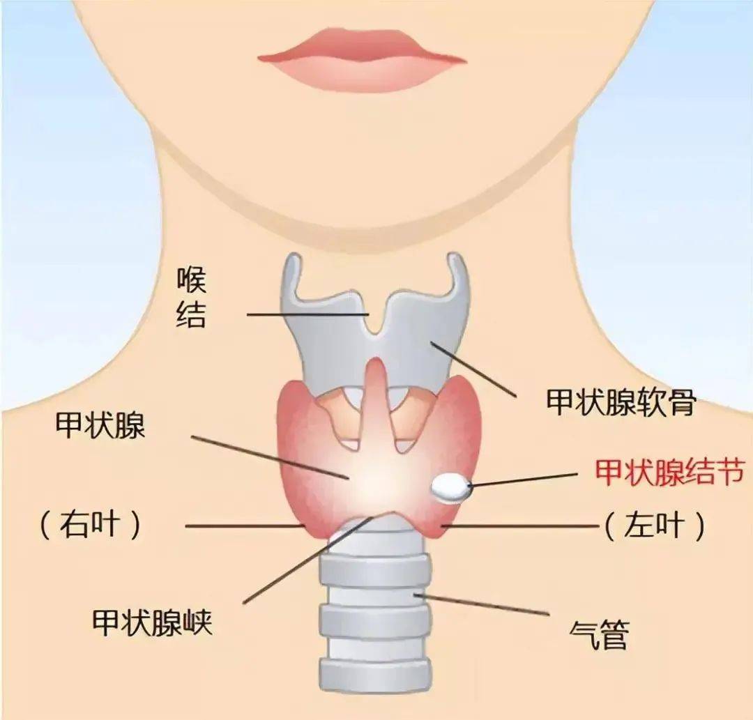 甲状腺结节究竟看哪个科?多学科联合门诊"一站式"解决