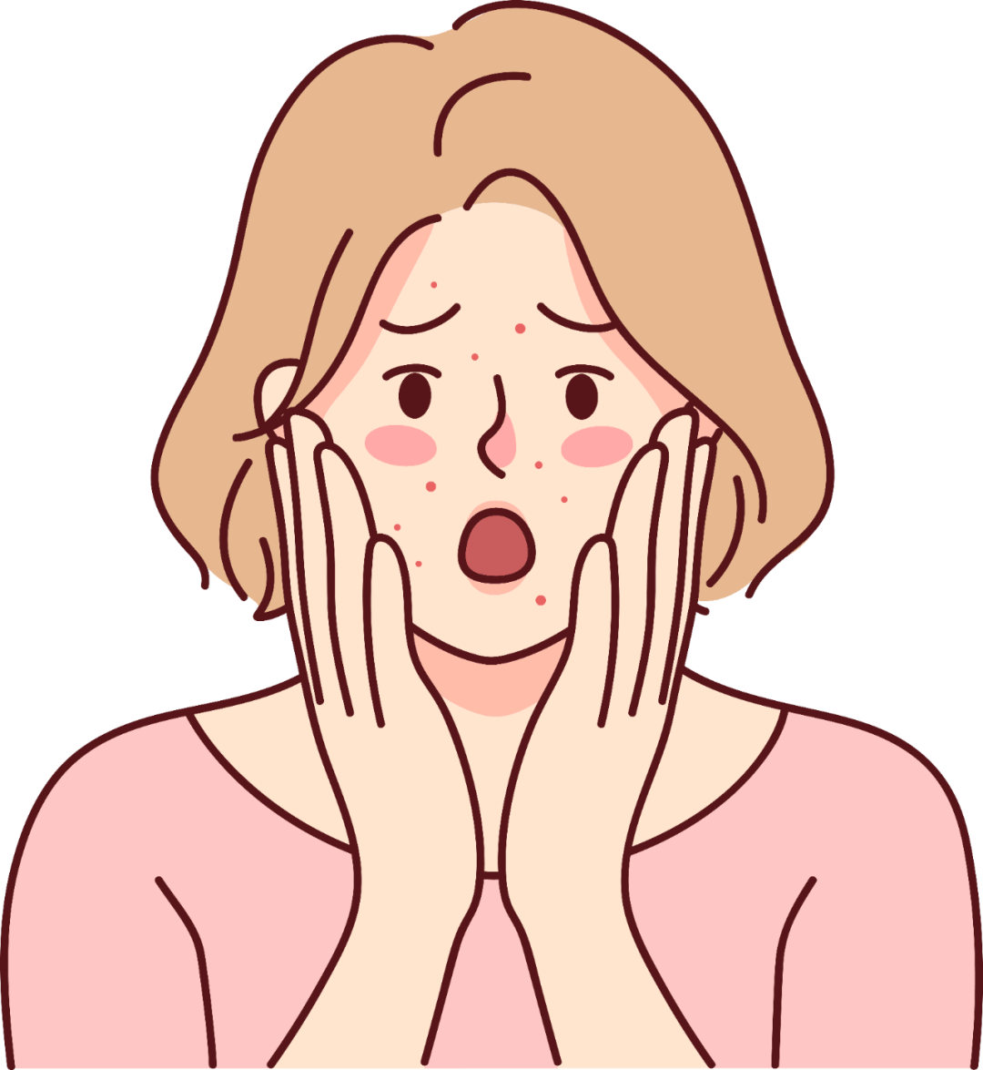 痘痘_治疗_建议