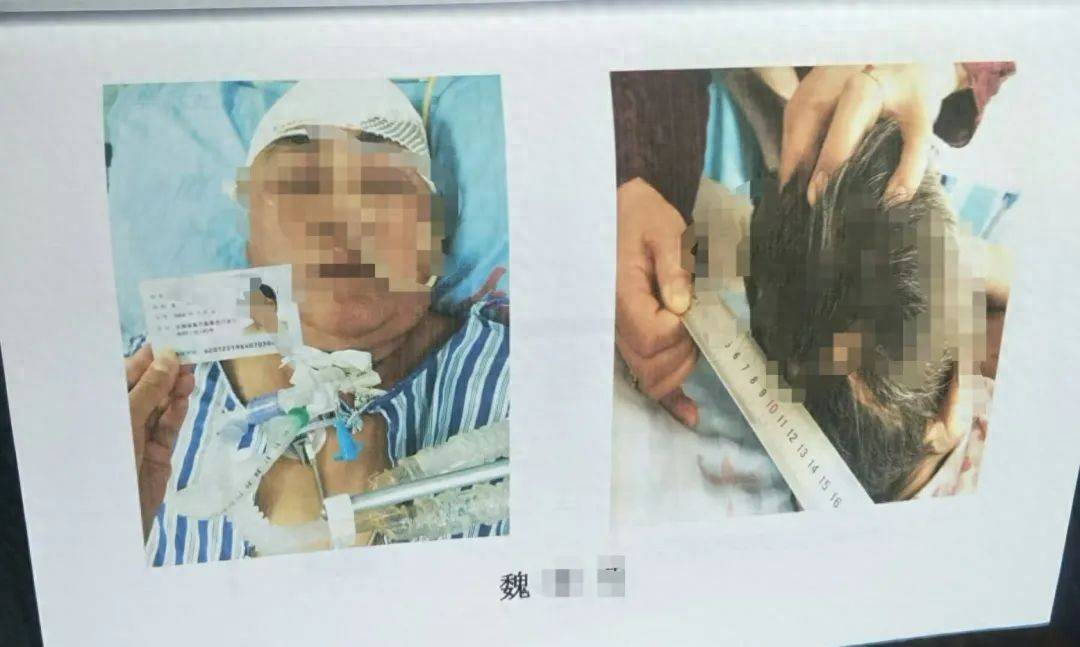 目睹母亲过马路被车撞，27岁女子受惊吓5天后身亡