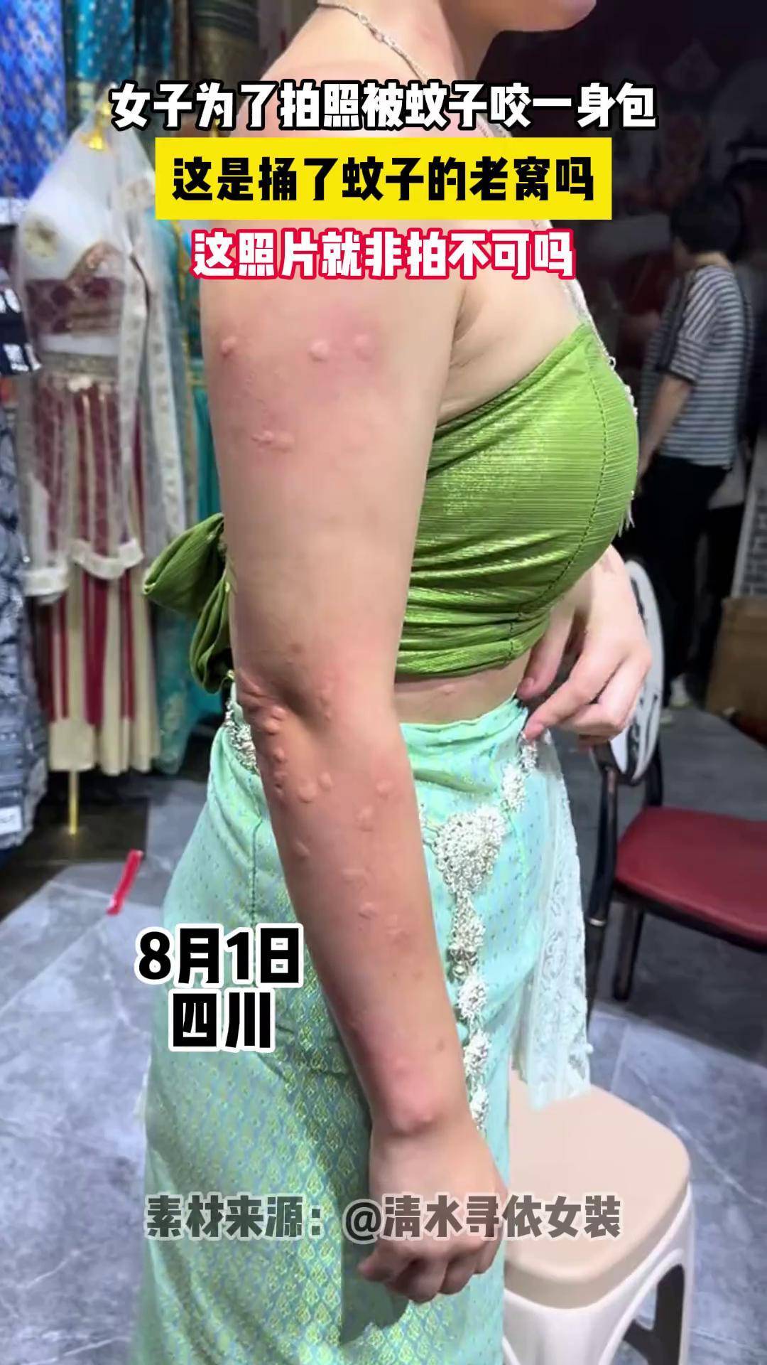 女子为了拍照被蚊子咬一身包被蚊子咬 蚊子包 蚊虫叮咬