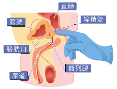 男人蛋疼是什么原因图片