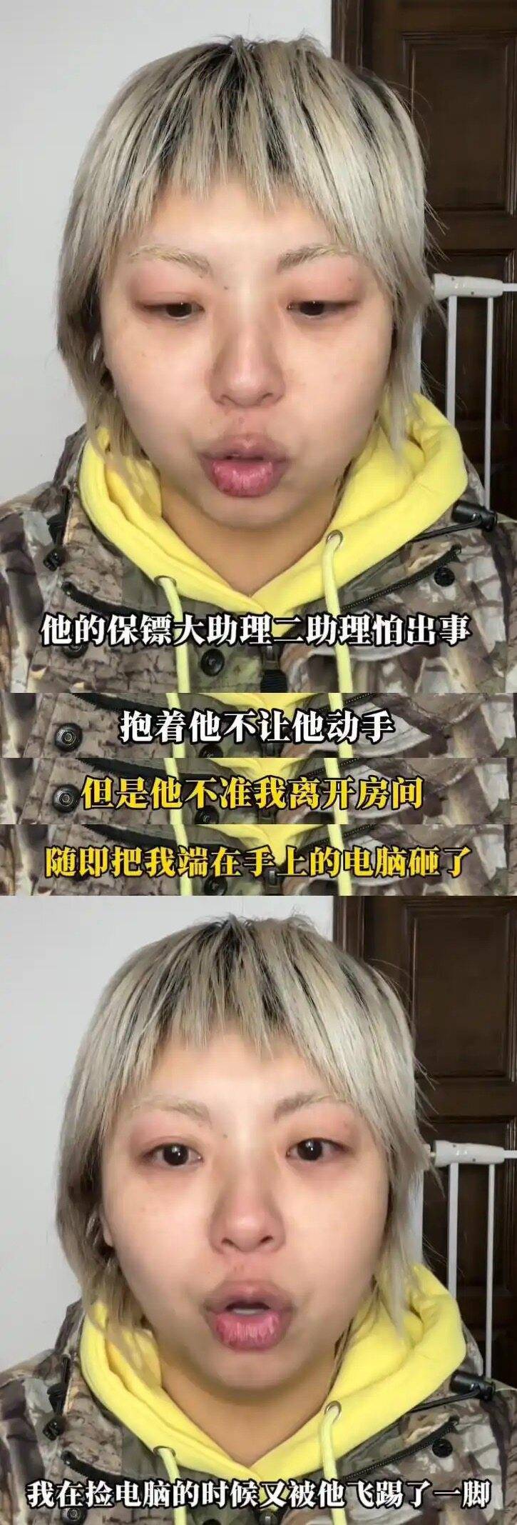 辱罵音頻、恐嚇視頻曝光！女網(wǎng)友自曝在酒店被藝人張大大毆打