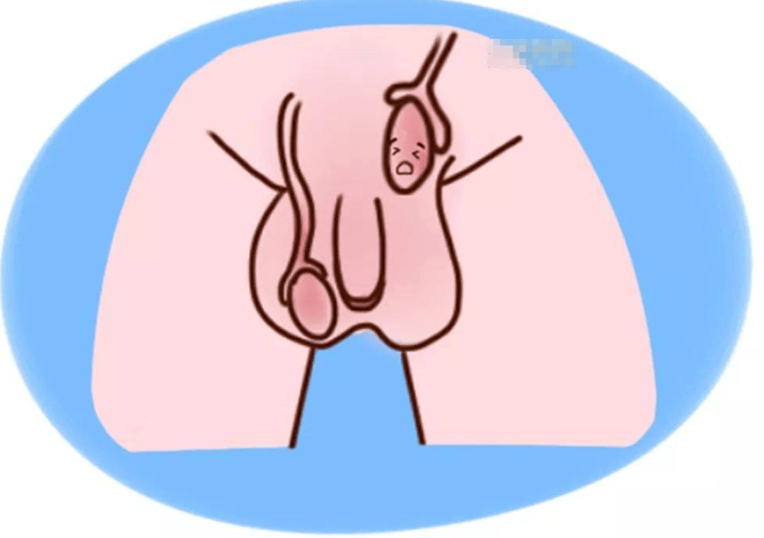 既然男人的蛋蛋那么脆弱,为什么还要悬挂在体外?