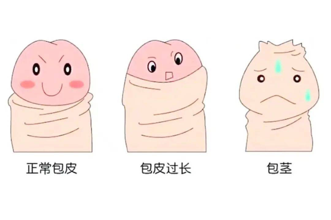 北京儿童医院安冰教授3月15日莲池亲诊:小儿包皮包茎与女童妇科问题一