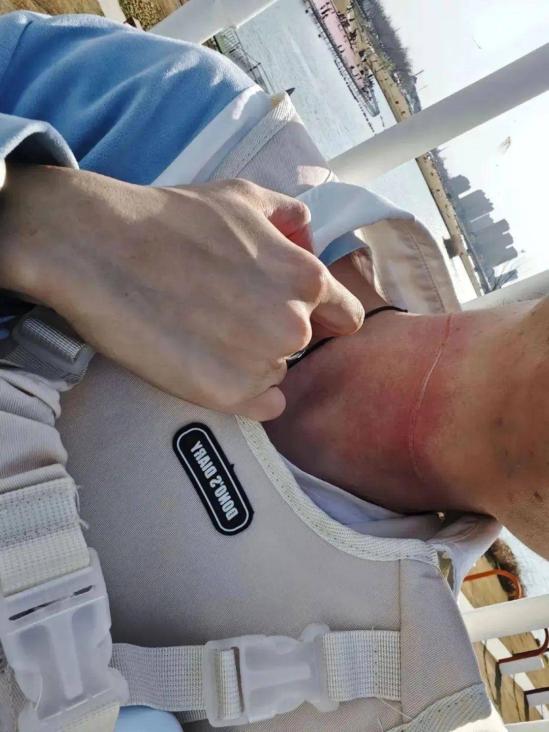 触目惊心男孩紧急前往医院进行救治割伤了脖子突然被横在路上的风筝线