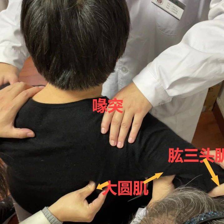 肩痛好了,为什么背手困难好不了?_临床_医学_培训