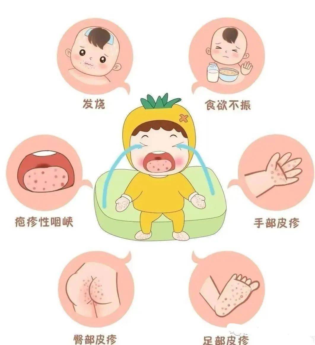 水痘高发季来临,这些防护知识请收好