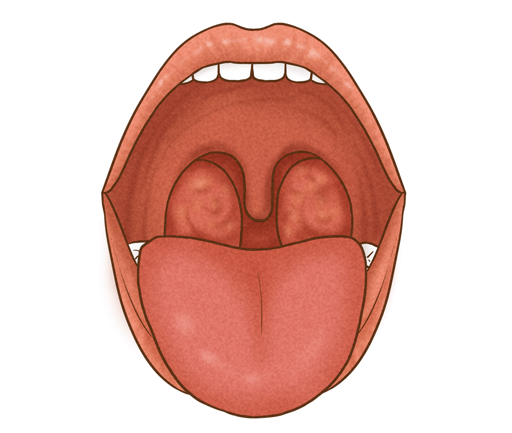 不吃药,不开刀!中医啄治法 轻松治愈扁桃体反复肿大