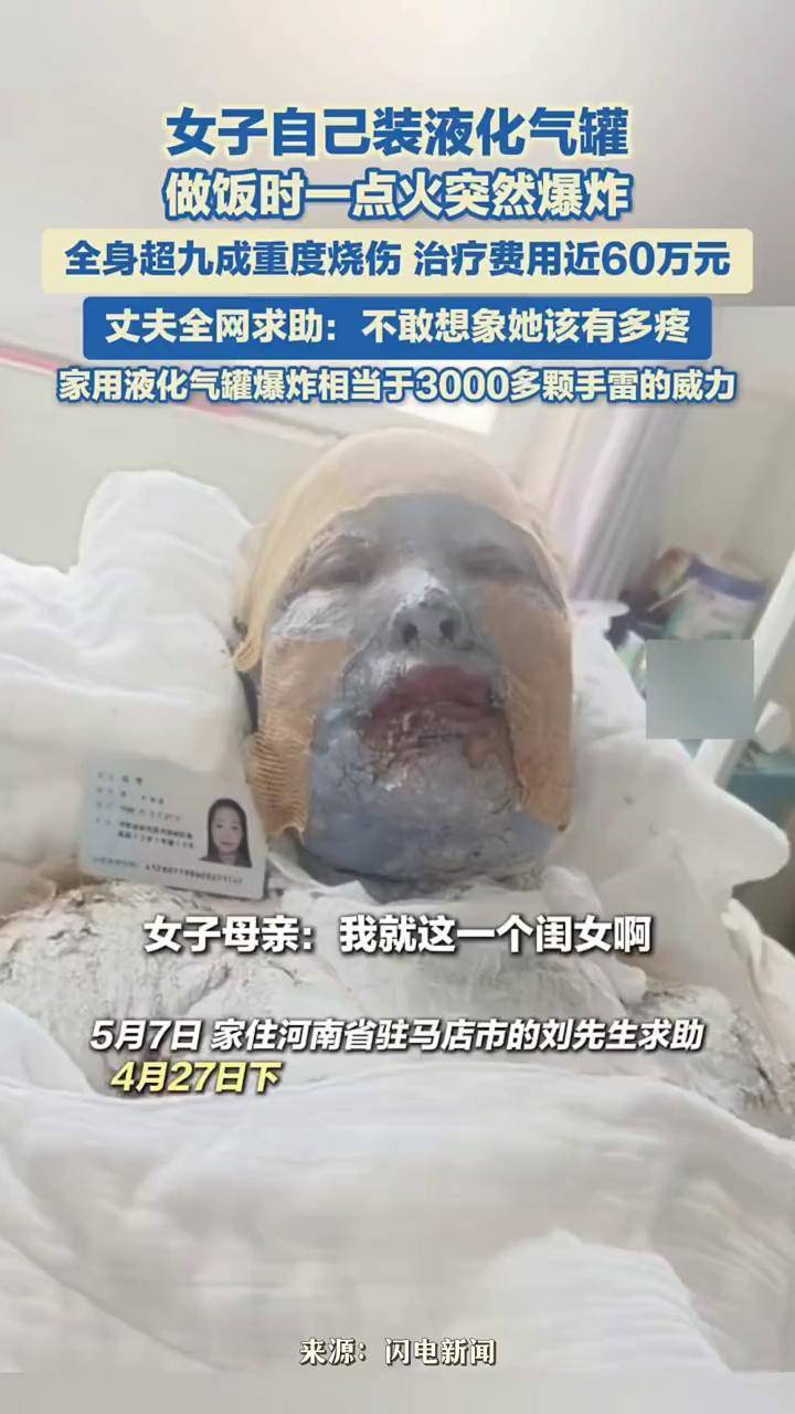 女子自己装液化气罐,做饭时一点火突然爆炸,全身超九成重度烧伤