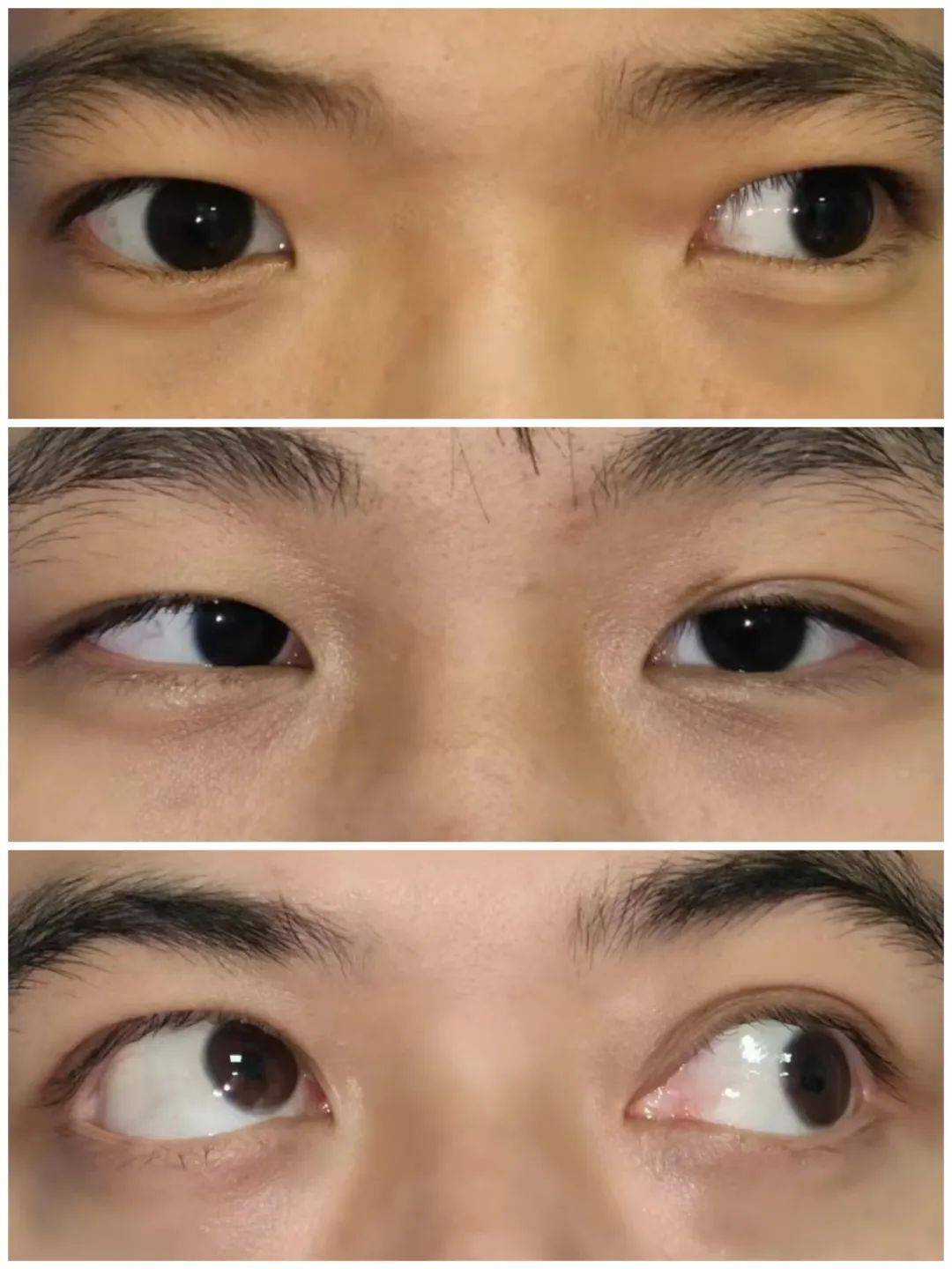 The cover picture of the next content