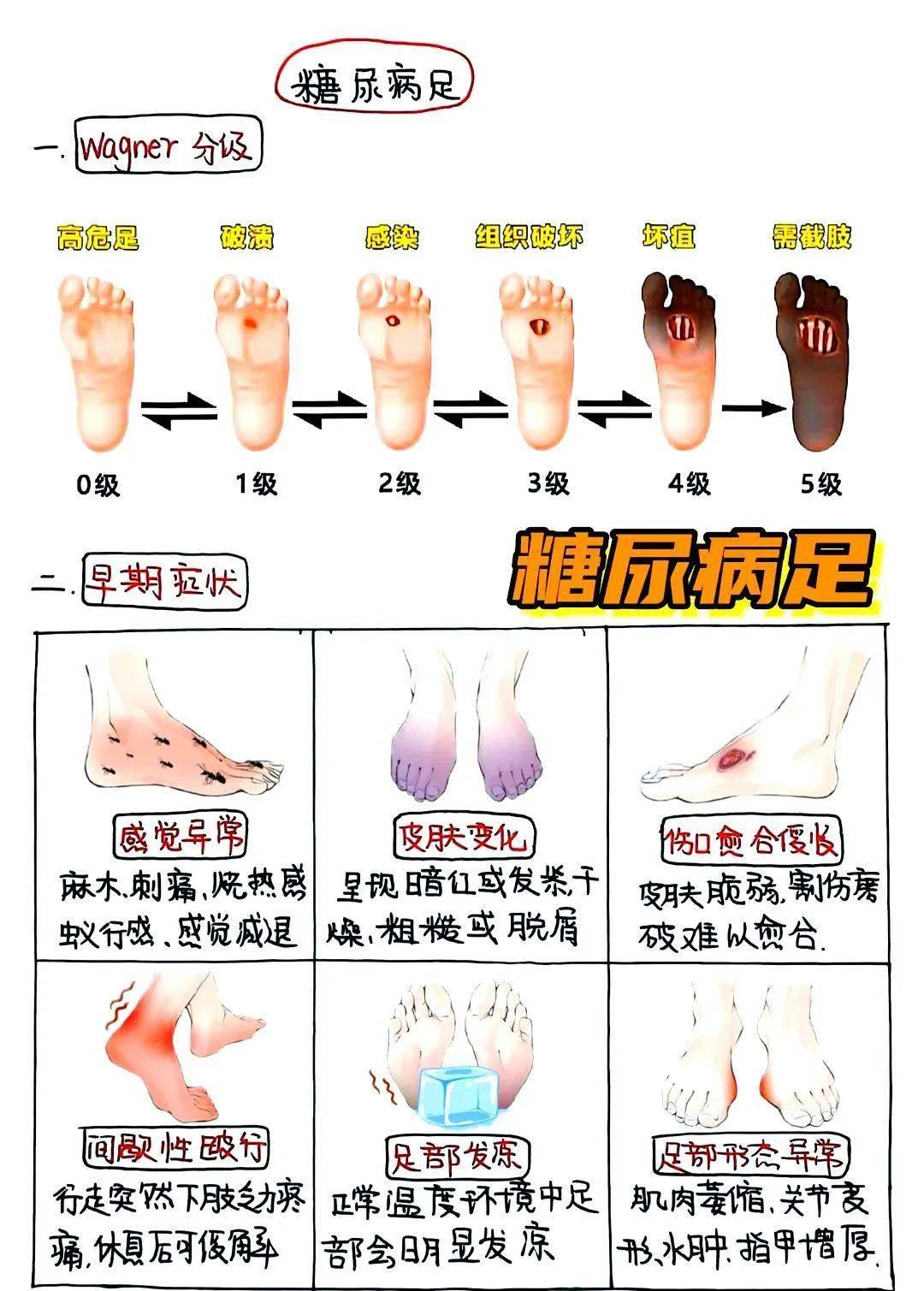 双脚在报警!糖友警惕这5个糖尿病足早期信号