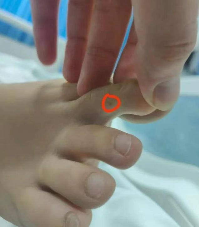 毒蛇还是毒虫咬伤？有无延误治疗？三亚市卫健委介入调查女游客身亡事件