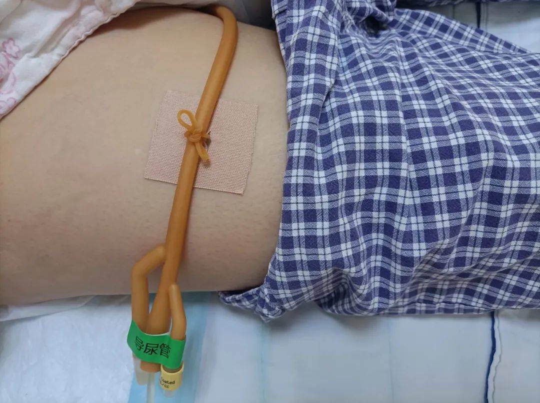 尿管居家护理攻略