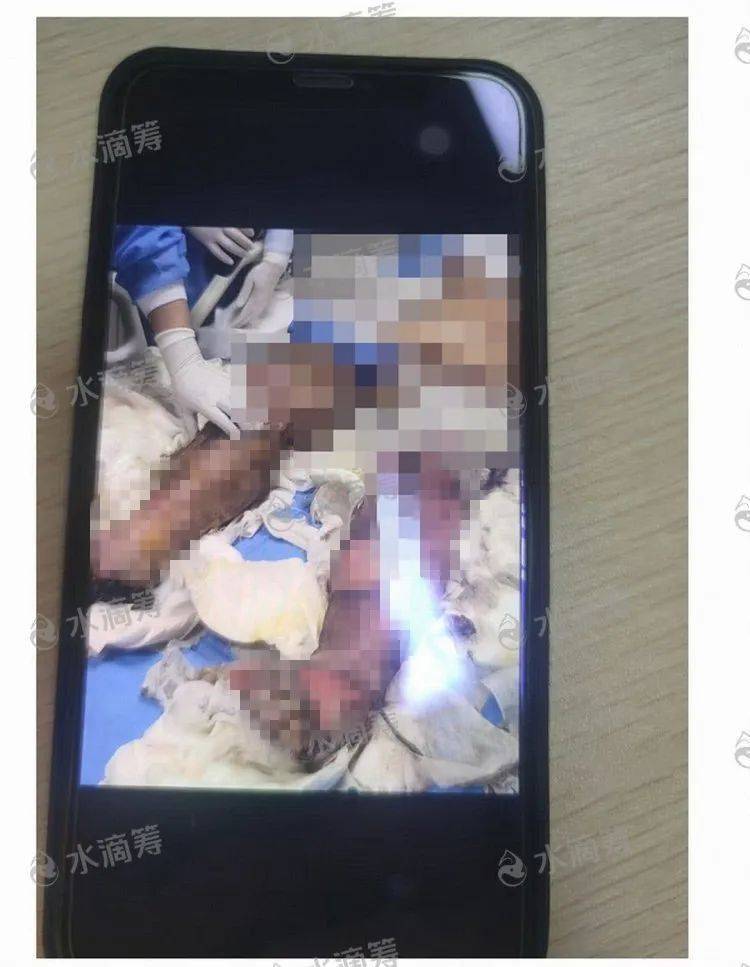 飞蛾小说:成都一小区6楼租户“飞线充电”，遭遇强降雨造成短路酿火灾，一家四口1死2伤