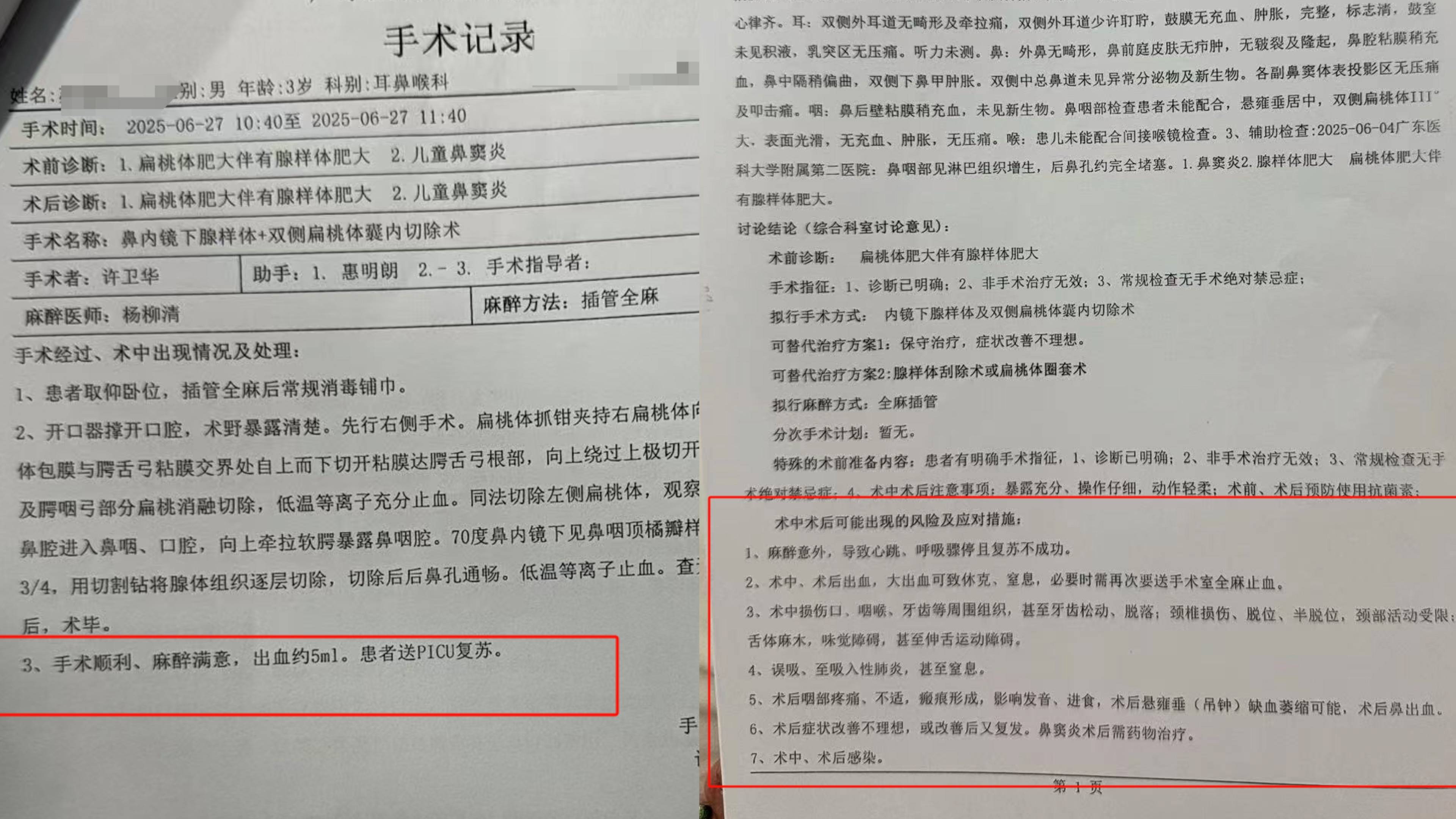 3岁男孩做扁桃体切除手术致脑死亡