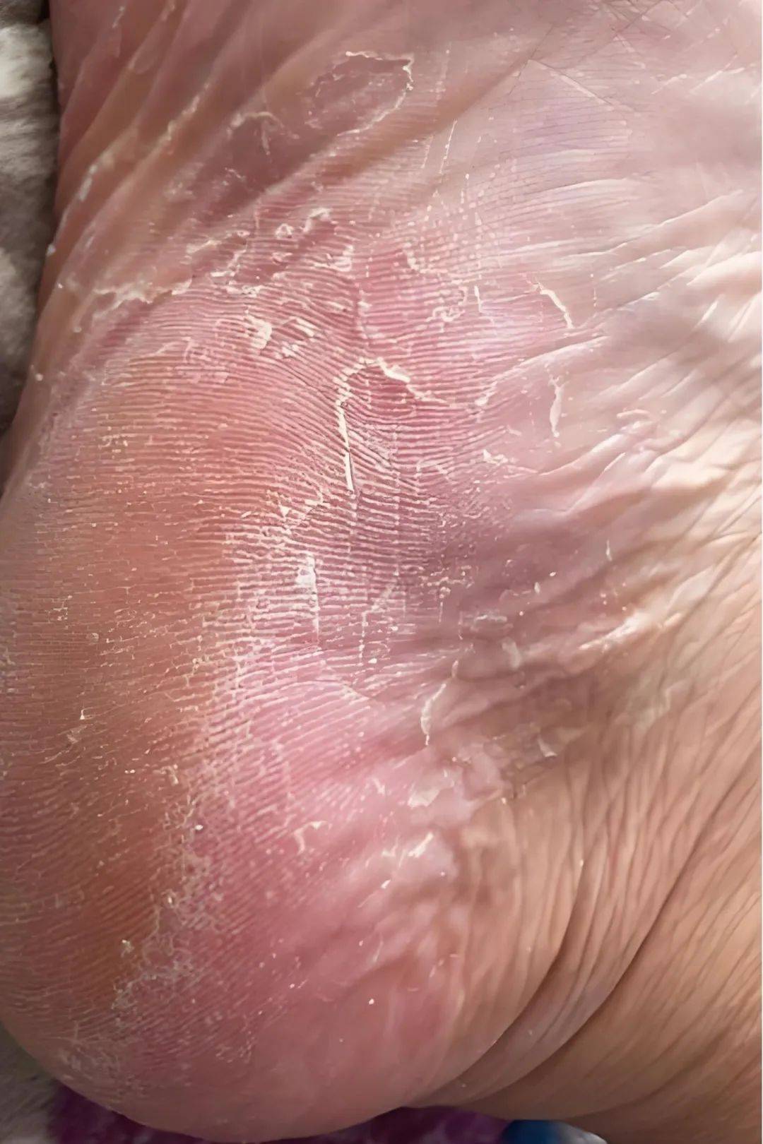 【曙光·专题】诊疗一线