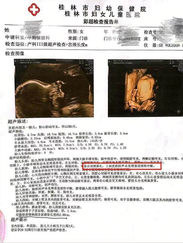一名妇女说,该婴儿被诊断出患有彩色超声检查