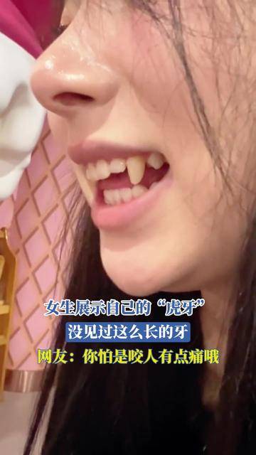 女生展示自己的"虎牙",没见过这么长的牙,网友:你怕是咬人有点痛哦