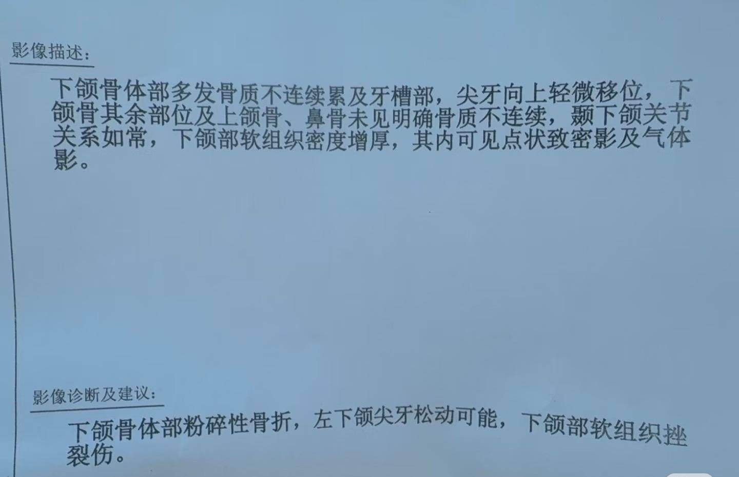 “飞来横石”砸穿挡风玻璃致司机面部骨折 当事人：仍不知石头来源 警方立案调查