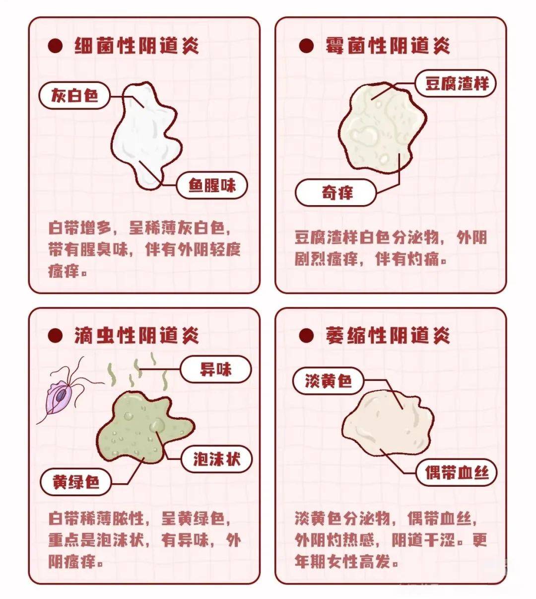 伴随症状:外阴瘙痒,灼痛,性交痛,尿频尿急等,提示可能存在阴道炎,宫颈