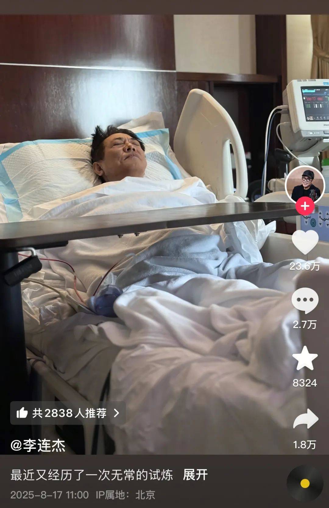 向太透露李连杰病情