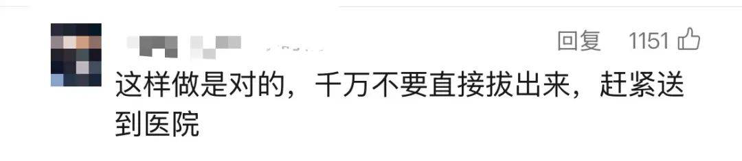 3岁女童头上插刀淡定就医，公安介入！受伤原因是……