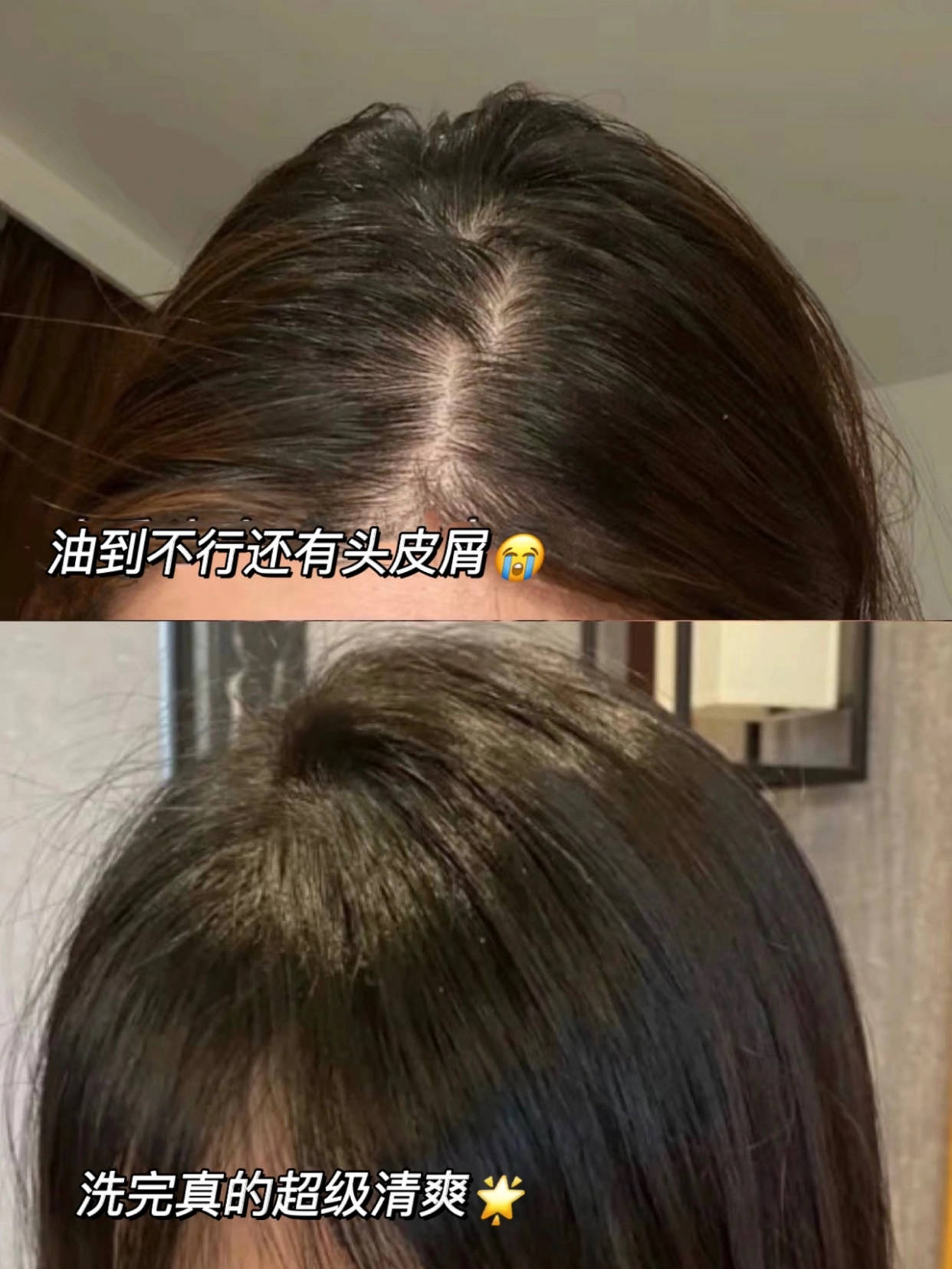 怎样使头顶的头发变得更加蓬松?油头蓬松洗发水技巧攻略