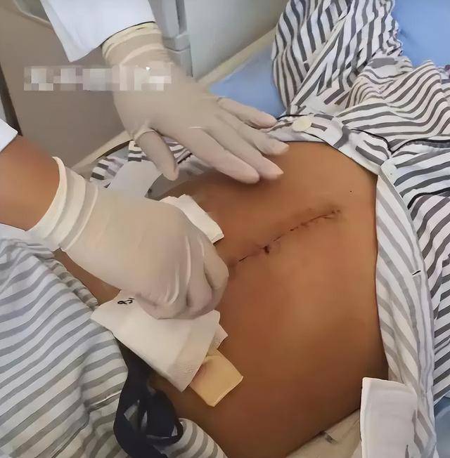 医生说要肝移植的时候
