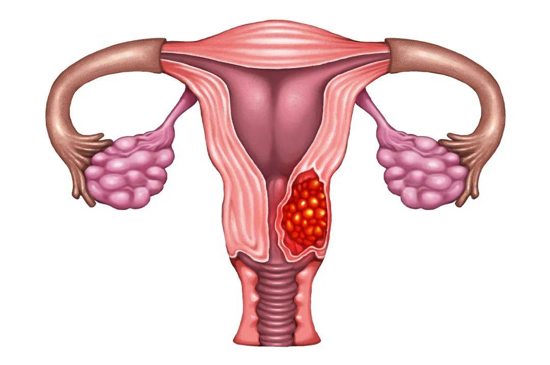 为什么女生阴道会变黑