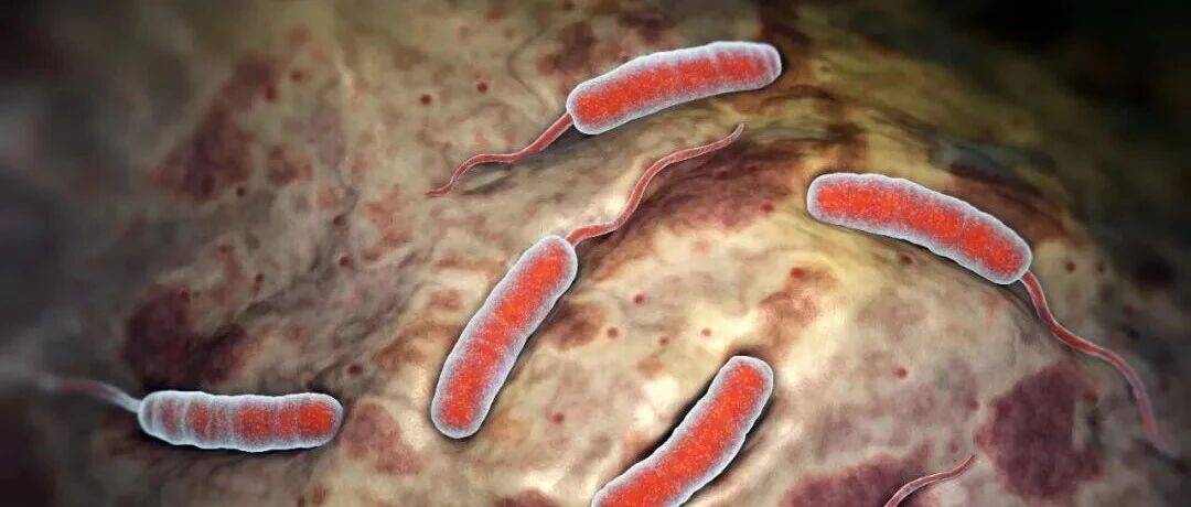 关于霍乱,这些知识你一定要知道_症状_传播_食物