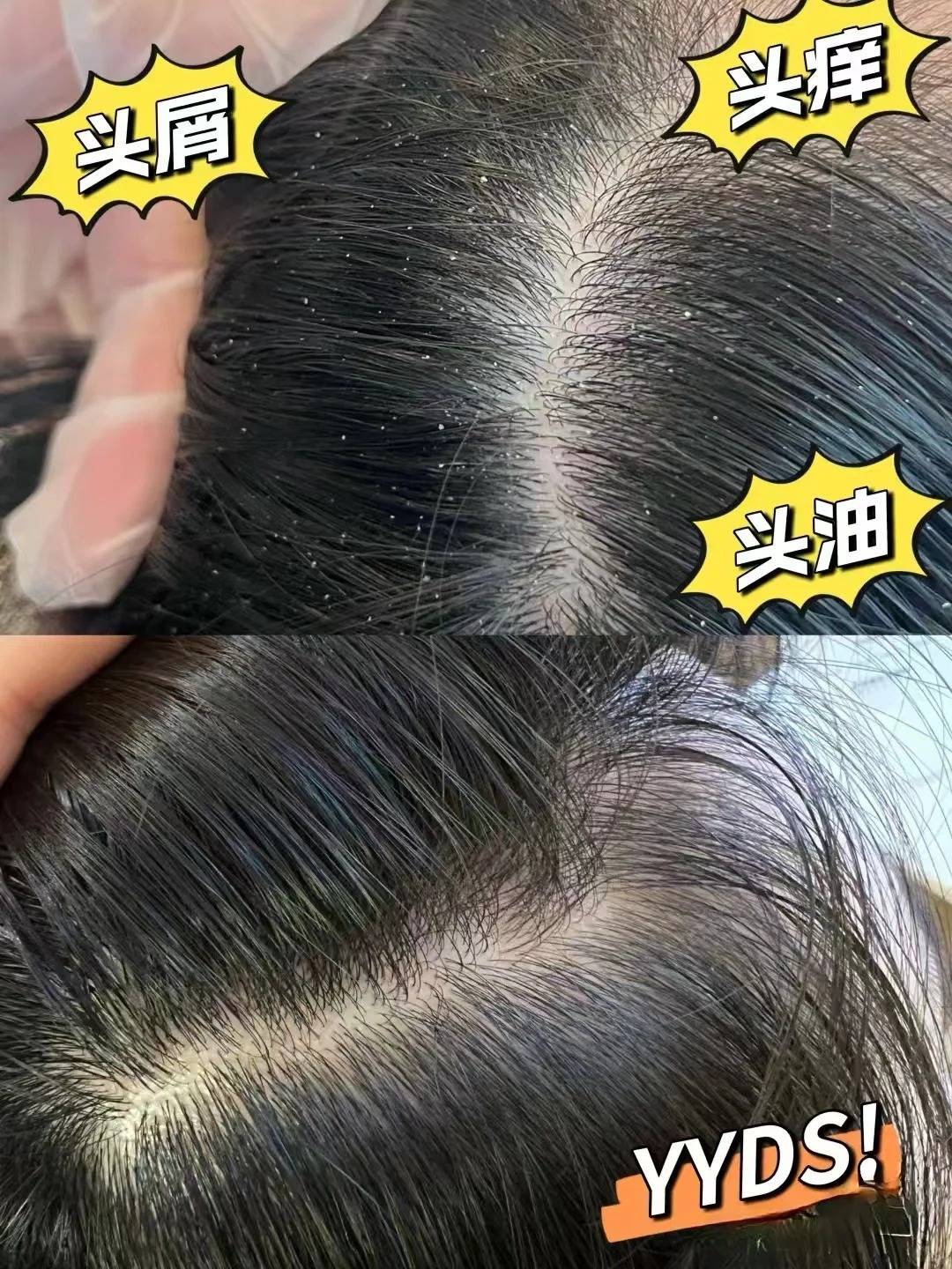 怎么洗头头发会蓬松?去油去屑洗发水攻略