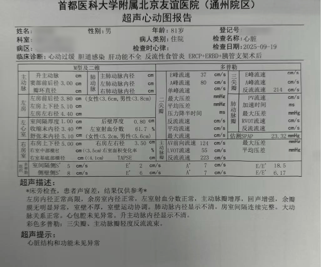 友谊医院CT加急-友谊医院照ct当天不能照上吧 