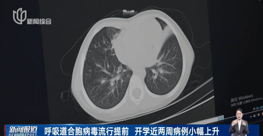 传染高发期来了！不少孩子“中招”，这种病毒来势汹汹