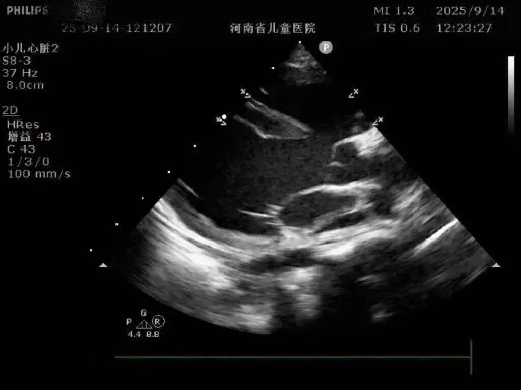 心脏不是爱心形状?红蓝血流藏玄机?这篇心超科普,解答娃的所有好奇