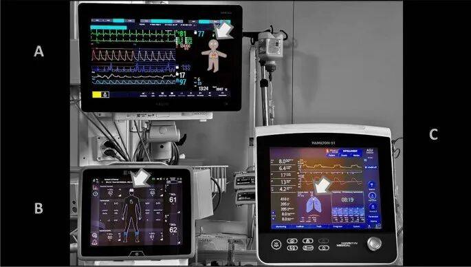 ICU昏迷不醒，AI判决生死！取意愿平均值，细思极恐