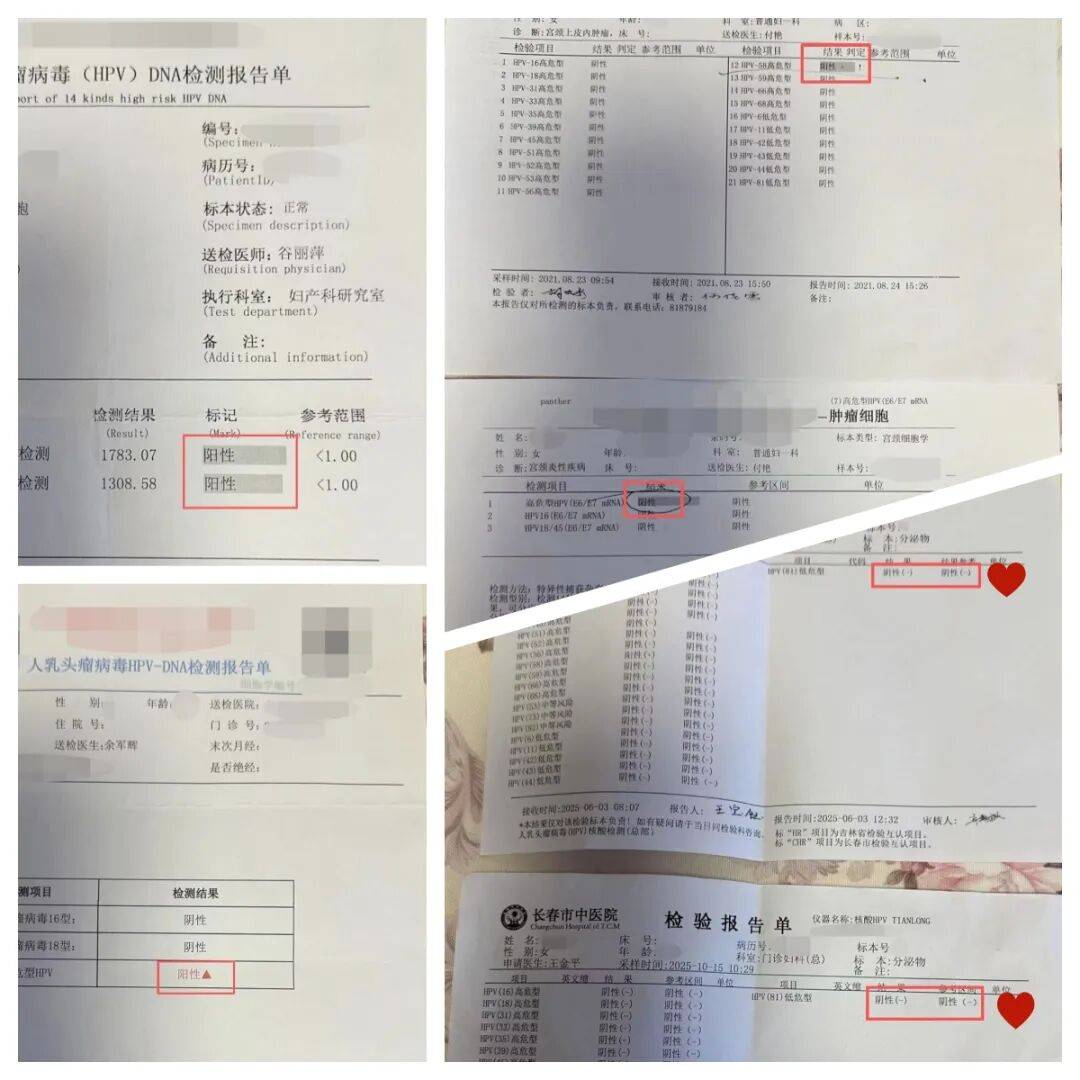 8年hpv终转阴!跨越千里寻良方,总部妇科助她重燃备孕希望