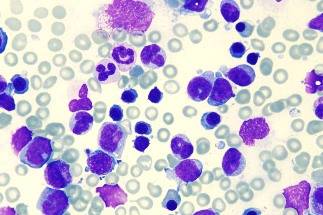 儿童单核细胞增高原因探索