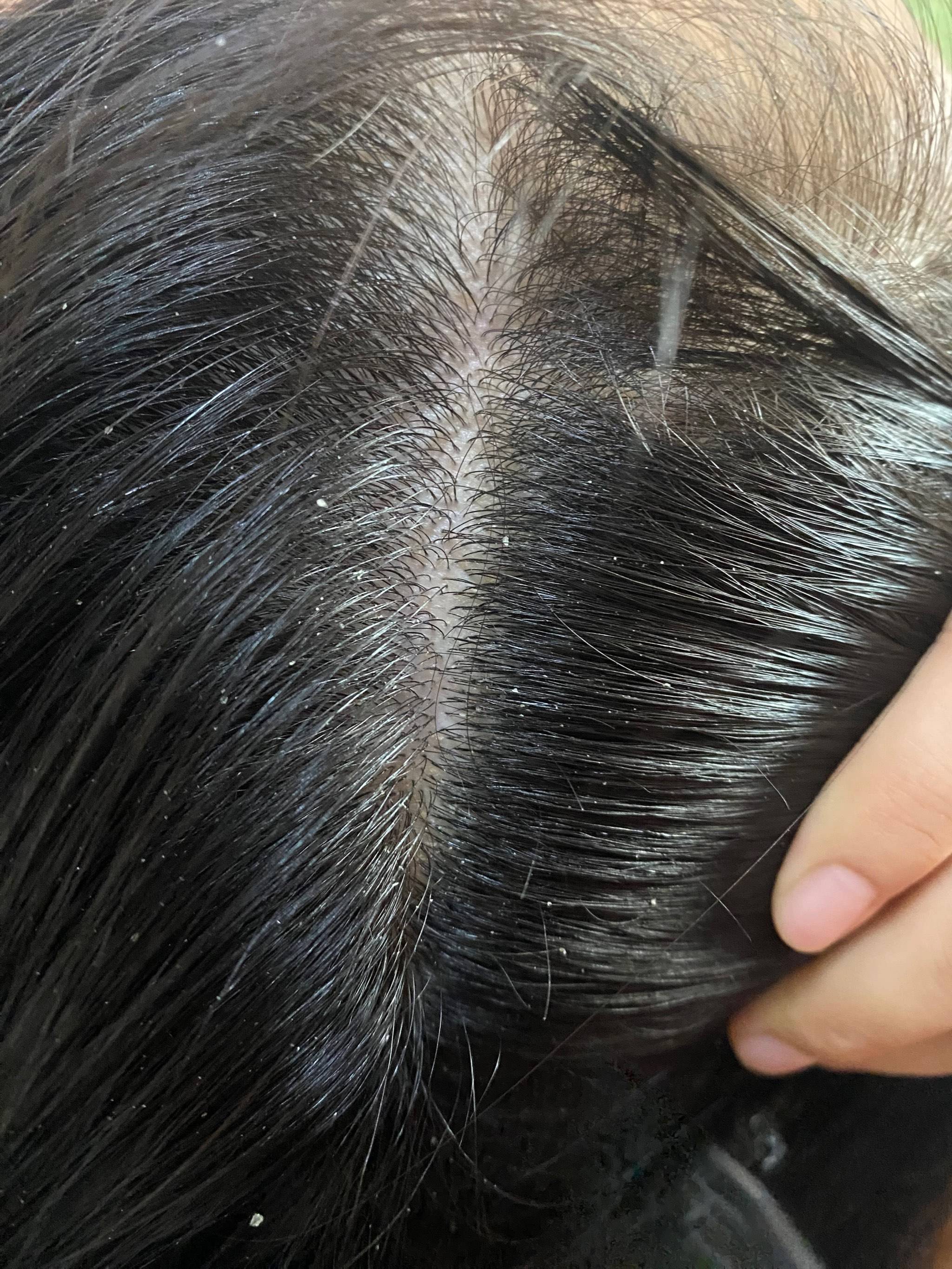 去屑控油选优质洗发水