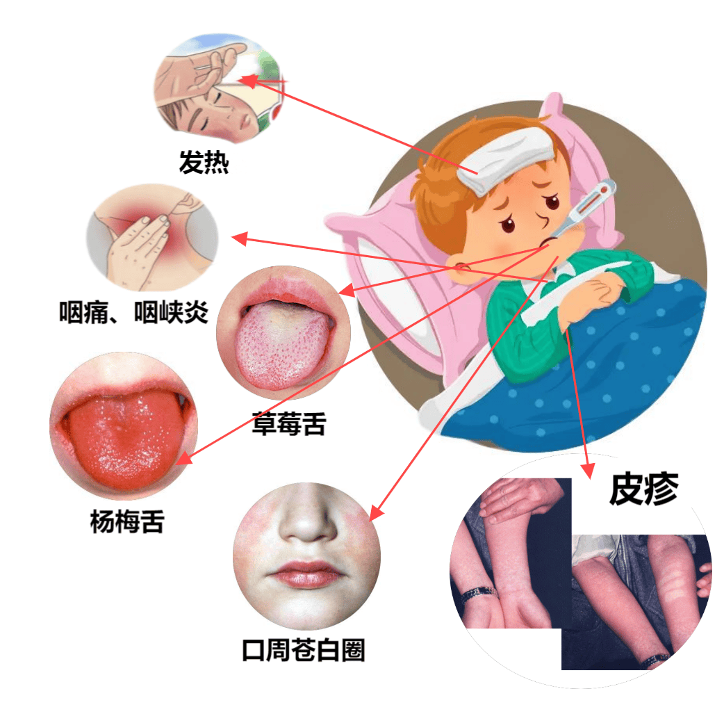 无疫苗,这种病已进入高发期→