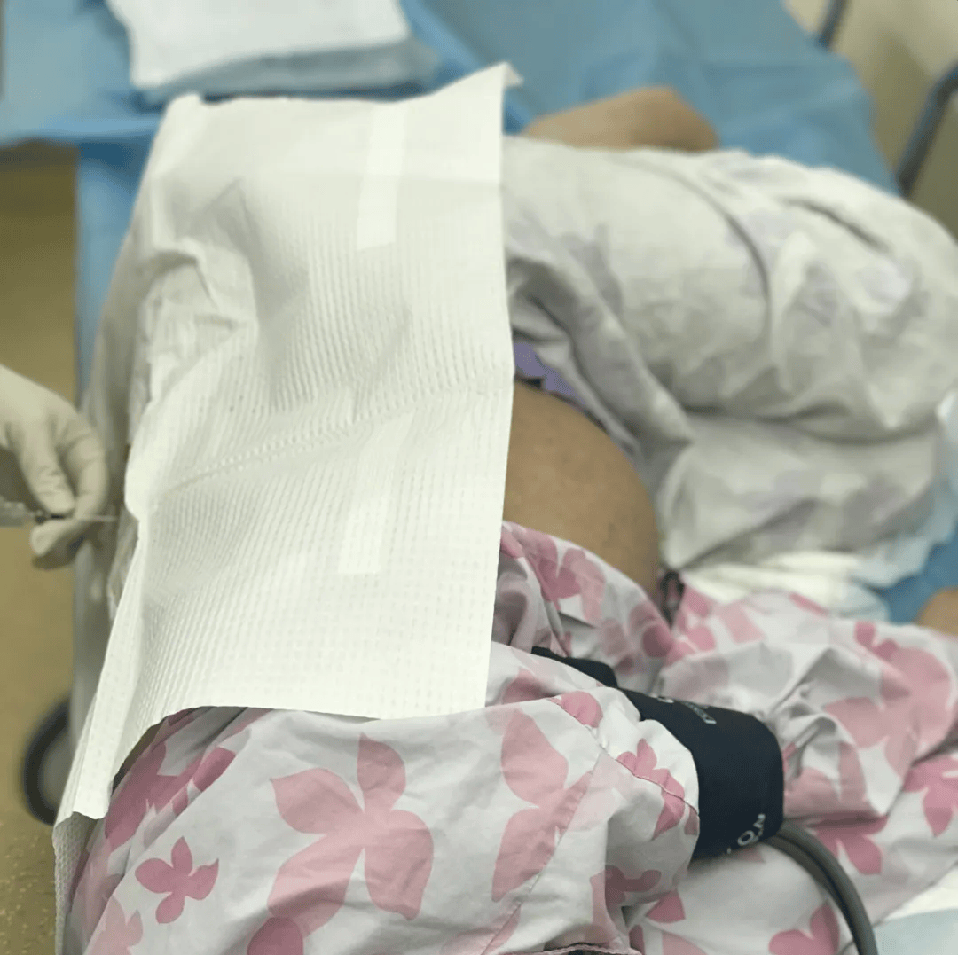 选择无痛分娩前,你最好知道的7件事