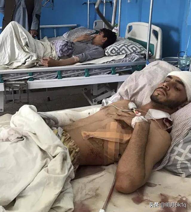 美军在委内瑞拉动武遭重创,7人受伤1人腿部中弹