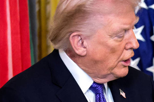 脖子上被发现“红色皮疹”，白宫：特朗普正接受治疗 -华闻时空