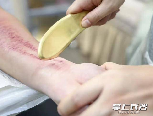 《逐玉》刮痧场景刷屏，看看当下“中医护士版刮痧指南”吧_黄杰斌_皮肤_经络